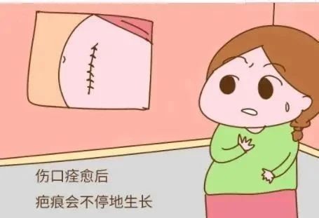 疤痕增生
