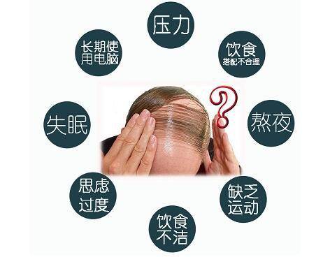 脱发02